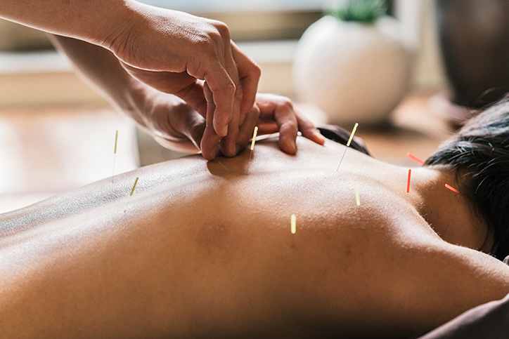 acupuncture multiple myeloma
